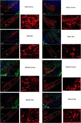 Paraquat Toxicogenetics: Strain-Related Reduction of Tyrosine Hydroxylase Staining in Substantia Nigra in Mice
